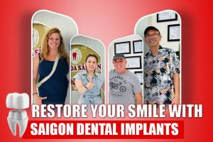 https://saigonimplant.com/wp-content/uploads/2024/08/Saigon-Dental-implants.jpg
