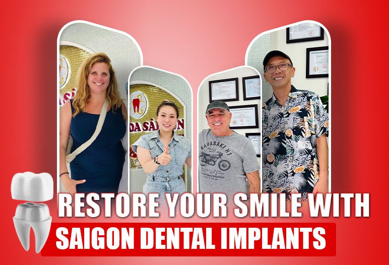 https://saigonimplant.com/wp-content/uploads/2024/08/Saigon-Dental-implants.jpg